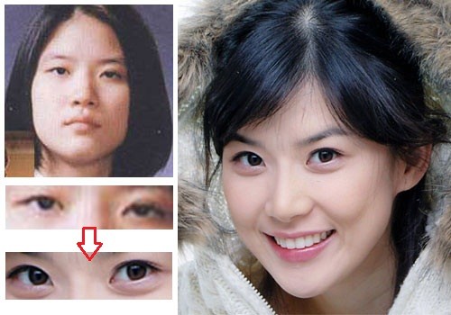 Cach-lam-mat-2-mi-tu-nhien2