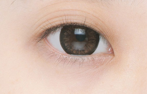 Làm sao để điều chỉnh mắt nhiều mí hiệu quả?