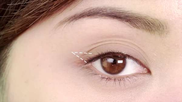 Mắt 3 mí là gì và có cách nào khắc phục mắt nhiều mí không?