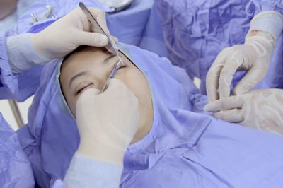 Trường hợp nào nên bấm mí?