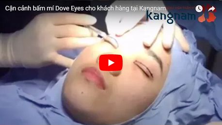 BẤM MÍ MẮT DOVE EYES - MẮT 2 MÍ HÚT HỒN CHỈ SAU 20 PHÚT7