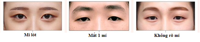BẤM MÍ MẮT DOVE EYES - MẮT 2 MÍ HÚT HỒN CHỈ SAU 20 PHÚT1