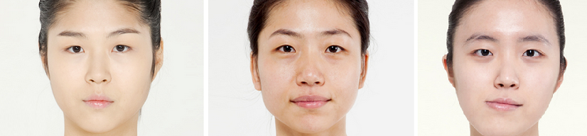 Đối tượng áp dụng tạo mắt hai mí