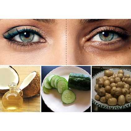 Top 7 cách trị thâm quầng mắt hiệu quả sau 1 đêm cực đơn giản