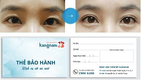 Phẫu thuật cắt mí mắt Hàn Quốc ở đâu đẹp