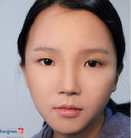 Có nên thẩm mỹ mắt to mắt nhỏ không 1