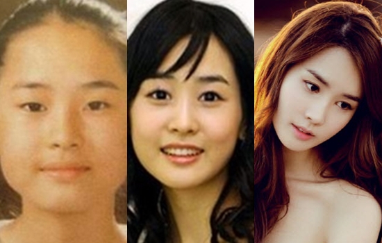 Bí quyết làm mắt 2 mí không cần phẫu thuật