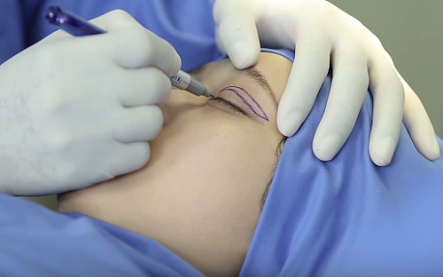 Bạn cần tìm hiểu chi tiết về các phương pháp bấm mí 1