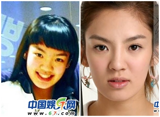snsd dang yeu hon nho bam mi mat